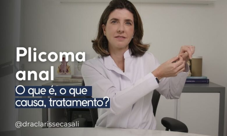 Plicoma Anal: O Que É, Causas, Tratamentos e Tudo Que Você Precisa Saber