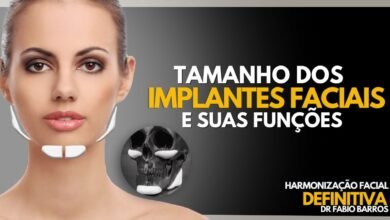 Tamanho dos Implantes Faciais e Suas Funções