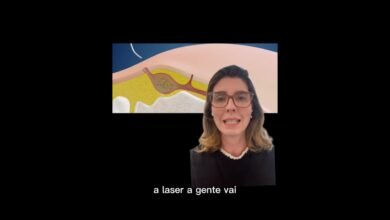 Tratamento de Cisto Pilonidal a Laser