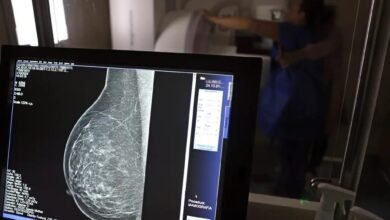 PBH investe em exames de mamografia e calcula 83 mil atendimentos em 2025