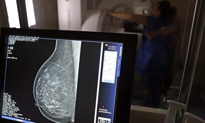 PBH investe em exames de mamografia e calcula 83 mil atendimentos em 2025